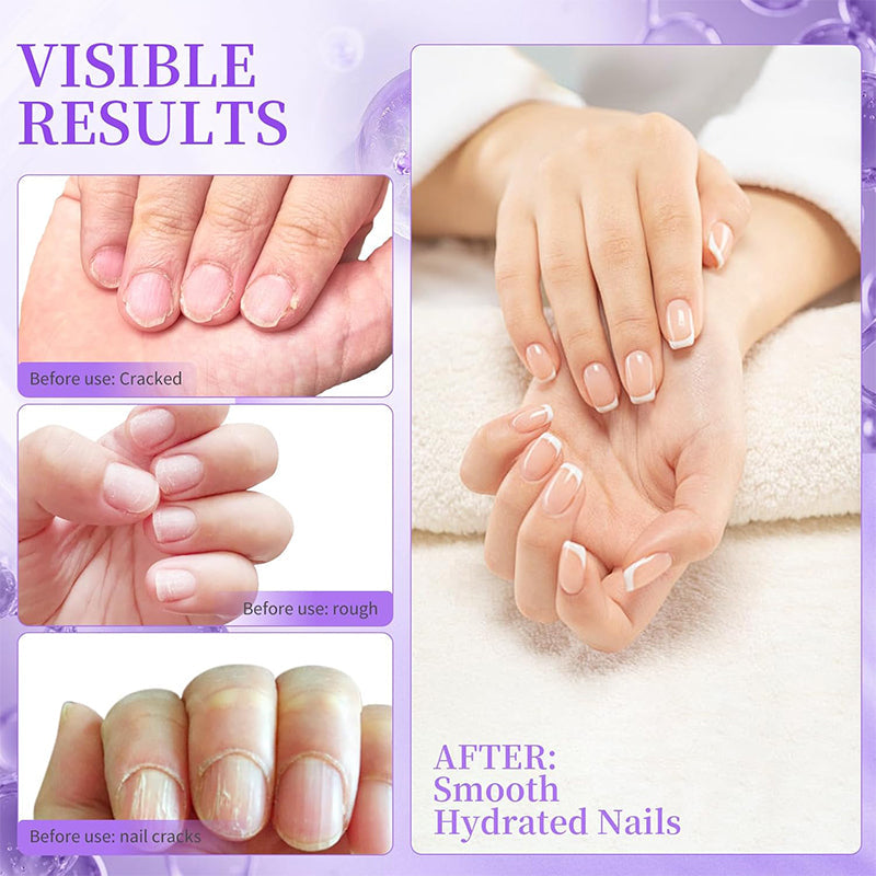 NailSoothe – Ravitseva kynsinauhaöljykynä